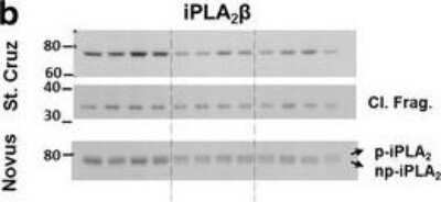 Western Blot: PLA2G6 Antibody [NBP1-81586] - Effects of APPWT and APPOSK overexpression on the levels of the major phospholipase A2s in the brains of old mice. Cerebrum samples from non-Tg, APPWT and APPOSK were lyophilized, pulverized, and homogenized in NP40 buffer using a cooled bead beater. Total protein concentrations from NP40 supernatants were estimated by BCA protein assay. Representative Western blots using multiple antibodies against PLA2. Image collected and cropped by CiteAb from the following publication (//actaneurocomms.biomedcentral.com/articles/10.1186/s40478-017-0460-6), licensed under a CC-BY license.