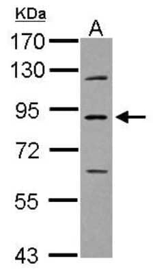 Western Blot PLA2G6 Antibody