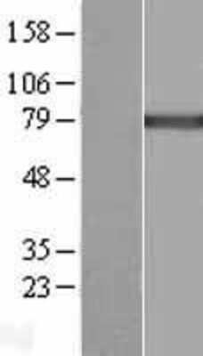 Western Blot: PLA2G6 Overexpression Lysate (Adult Normal) [NBL1-14476] Left-Empty vector transfected control cell lysate (HEK293 cell lysate); Right -Over-expression Lysate for PLA2G6.