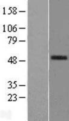 Western Blot: PLA2G7 Overexpression Lysate (Adult Normal) [NBL1-14477] Left-Empty vector transfected control cell lysate (HEK293 cell lysate); Right -Over-expression Lysate for PLA2G7.