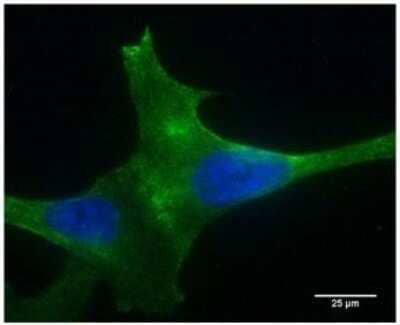 Immunocytochemistry/Immunofluorescence: PLA2R1 Antibody (12-6-5) - Azide and BSA Free [NBP2-80912] - Staining of PLA2R over-expressing podocytes revealing cell surface expression of the PLA2R receptor. Dilution 1:400 (under 40x lens). Image from the standard format of this antibody.