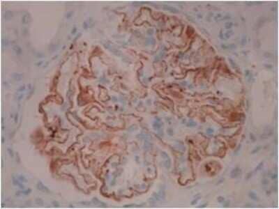 Immunohistochemistry: PLA2R1 Antibody (12-6-5) - Azide and BSA Free [NBP2-80912] - Membranous nephropathy kidney showing staining of PLA2R in the capillary wall of the glomerular basement membrane. IHC Protocol Info: HIER pH8 (CC1) for 64 minutes, 36 minute primary antibody (PLA2R Mouse 12-6-5) incubation at room temperature using a dil