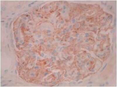 Immunohistochemistry: PLA2R1 Antibody (12-6-5) - Azide and BSA Free [NBP2-80912] - Normal human kidney showing podocyte specific staining. IHC Protocol Info: HIER pH8 (CC1) for 64 minutes, 36 minute primary antibody (PLA2R Mouse 12-6-5) incubation at room temperature using a dilution of 1:5000, using Ventana Ultraview DAB detection syst