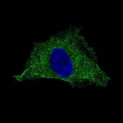 Immunocytochemistry/Immunofluorescence: PLA2R1 Antibody (CL0474) [NBP2-52933] - Staining of HeLa cells showing specific staining in the cytosol and plasma membrane in green. Microtubule- and nuclear probes are visualized in blue. Antibody staining is shown in green.