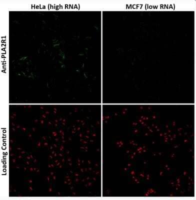 <b>Orthogonal Strategies Validation. </b>Immunocytochemistry/Immunofluorescence: PLA2R1 Antibody (CL0474) [NBP2-52933] - Enhanced validation of the Anti-PLA2R1 monoclonal antibody by comparing the immunofluorescence staining in human cell lines Hela and MCF7 exhibiting a relatively high and low expression of PLA2R1 (based on RNA-seq values), respectively. The PLA2R1 (green signal) is present in Hela cells but is absent in MCF7 cells. The anti-HDAC1 antibody was used as a loading control (red signal). Antibody staining is shown in green.