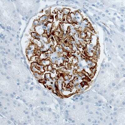 Immunohistochemistry-Paraffin: PLA2R1 Antibody (CL0474) [NBP2-52933] - Staining of human kidney with membranous nephropathy shows strong membranous immunoreactivity in renal glomeruli.