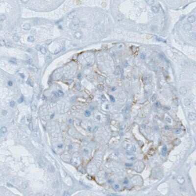 Immunohistochemistry-Paraffin: PLA2R1 Antibody (CL0474) [NBP2-52933] - Staining of human kidney shows weak membranous positivity in cells in glomeruli.