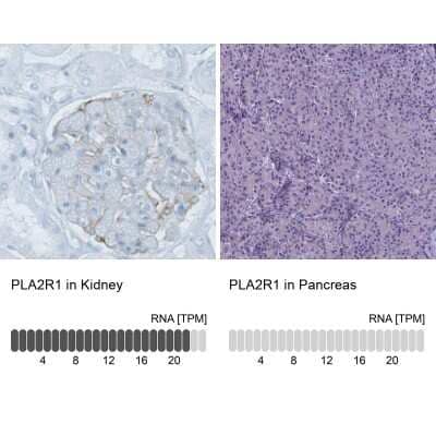 Immunohistochemistry-Paraffin: PLA2R1 Antibody (CL0474) [NBP2-52933] - Staining in human kidney and pancreas tissues. Corresponding PLA2R1 RNA-seq data are presented for the same tissues.