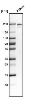 <b>Orthogonal Strategies Validation. </b>Western Blot: PLA2R1 Antibody (CL0474) [NBP2-52933] - Analysis in human kidney tissue.