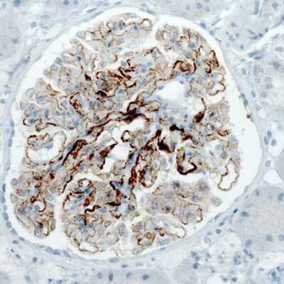 Immunohistochemistry-Paraffin: PLA2R1 Antibody (CL0485) [NBP2-52934] - Staining of human kidney with membranous nephropathy shows strong membranous immunoreactivity in renal glomeruli.