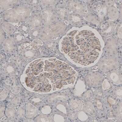 Immunohistochemistry-Paraffin: PLA2R1 Antibody [NBP1-84449] - Staining of human kidney shows weak membranous positivity in cells in glomeruli.