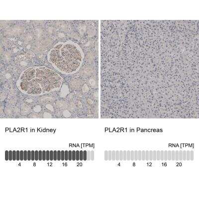 Immunohistochemistry-Paraffin: PLA2R1 Antibody [NBP1-84449] - Staining in human kidney and pancreas tissues . Corresponding PLA2R1 RNA-seq data are presented for the same tissues.