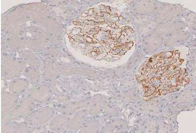 Immunohistochemistry-Paraffin: PLA2R1 Antibody [NBP1-84449] - Staining o human kidney  (idiopathic membranous nephropathy) shows strong membranous positivity in cells in glomeruli.