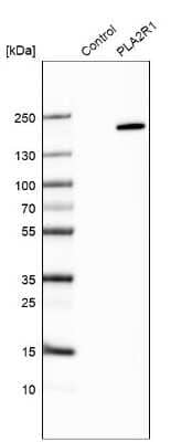 <b>Orthogonal Strategies Validation. </b>Western Blot: PLA2R1 Antibody [NBP1-84449] - Analysis in control (vector only transfected HEK293T lysate) and PLA2R1 over-expression lysate (Co-expressed with a C-terminal myc-DDK tag (3.1 kDa) in mammalian HEK293T cells).