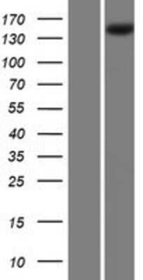 Western Blot: PLA2R1 Overexpression Lysate (Adult Normal) [NBP2-08815] Left-Empty vector transfected control cell lysate (HEK293 cell lysate); Right -Over-expression Lysate for PLA2R1.