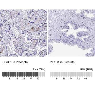Immunohistochemistry-Paraffin: PLAC1 Antibody [NBP2-32379] - Analysis in human placenta and prostate tissues. Corresponding PLAC1 RNA-seq data are presented for the same tissues.