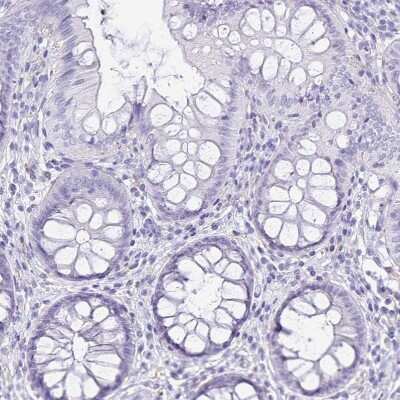 Immunohistochemistry-Paraffin: PLAC1 Antibody [NBP2-32379] - Staining of human colon shows no positivity in glandular cells as expected.