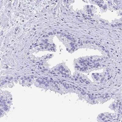 Immunohistochemistry-Paraffin: PLAC1 Antibody [NBP2-32379] - Staining of human prostate shows no positivity in glandular cells as expected.