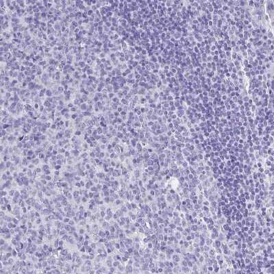 Immunohistochemistry-Paraffin: PLAC1 Antibody [NBP2-32379] - Staining of human tonsil shows no positivity in non-germinal center cells as expected.