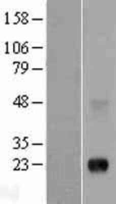Western Blot PLAC1 Overexpression Lysate