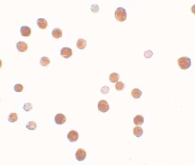 Immunocytochemistry/Immunofluorescence: PLAC4 Antibody [NBP2-41125] - Immunocytochemistry of PLAC4 in HeLa cells with PLAC4 antibody at 10 ug/mL.