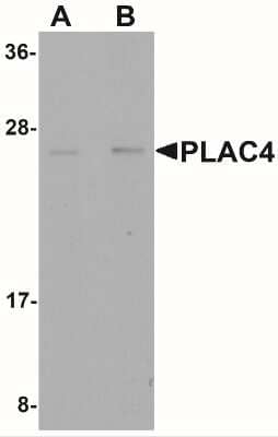 Western Blot: PLAC4 Antibody [NBP2-41125] - Western blot analysis of PLAC4 in human placenta tissue lysate with PLAC4 antibody at (A) 1 and (B) 2 ug/mL.