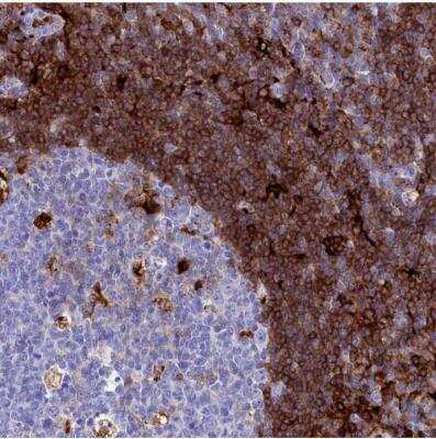 Immunohistochemistry-Paraffin: PLAC8 Antibody [NBP1-90721] - Staining of human lymphoid tissues shows moderate to strong cytoplasmic positivity in non-germinal center cells.