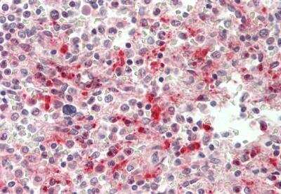 Immunohistochemistry-Paraffin: PLAC8 Antibody [NBP2-85485] - Rabbit Anti-PLAC8 antibody. Catalog Number: ARP47959. Formalin Fixed Paraffin Embedded Tissue: Human Spleen. Primary antibody Concentration: 1:100. Secondary Antibody: Donkey anti-Rabbit-Cy3. Secondary Antibody Concentration: 1:200. Magnification: 20x. Exposure Time: 0.5-2.0sec