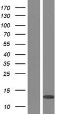 Western Blot: PLAC8 Overexpression Lysate (Adult Normal) [NBP2-09520] Left-Empty vector transfected control cell lysate (HEK293 cell lysate); Right -Over-expression Lysate for PLAC8.