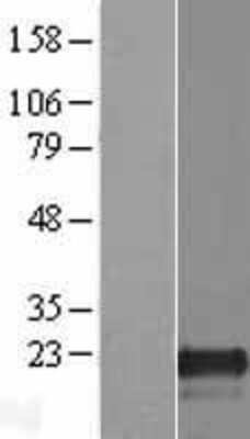 Western Blot: PLAC8L1 Overexpression Lysate (Adult Normal) [NBP2-08599] Left-Empty vector transfected control cell lysate (HEK293 cell lysate); Right -Over-expression Lysate for PLAC8L1.