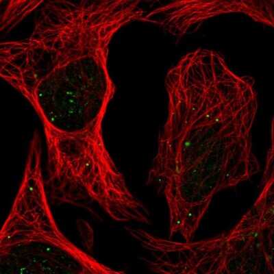 Immunocytochemistry/Immunofluorescence: PLAGL1 Antibody [NBP2-56498] - Staining of human cell line U-2 OS shows localization to nuclear bodies, the Golgi apparatus & vesicles.