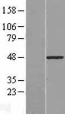 Western Blot: PLAGL1 Overexpression Lysate (Adult Normal) [NBP2-08412] Left-Empty vector transfected control cell lysate (HEK293 cell lysate); Right -Over-expression Lysate for PLAGL1.