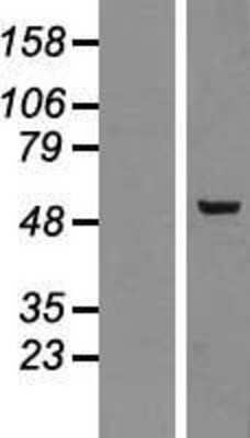 Western Blot: PLAGL2 Overexpression Lysate (Adult Normal) [NBP2-08085] Left-Empty vector transfected control cell lysate (HEK293 cell lysate); Right -Over-expression Lysate for PLAGL2.