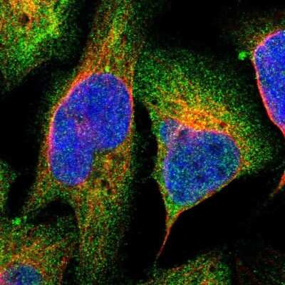 <b>Independent Antibodies Validation. </b>Immunocytochemistry/Immunofluorescence: PLAP Antibody [NBP1-84997] - Immunofluorescent staining of human cell line U-2 OS shows localization to cytosol.