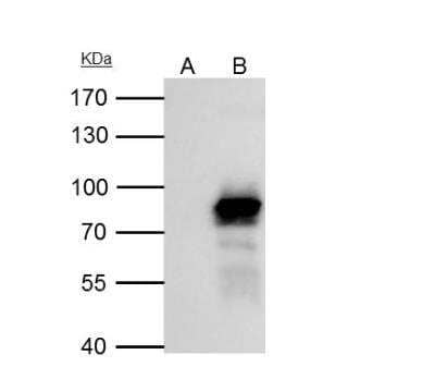 Immunoprecipitation: PLAP Antibody [NBP2-19858] - IP Sample: NT2D1 whole cell lysate/extract A : Control with 3 ug of pre-immune rabbit IgG B : Immunoprecipitation of PLAP by 3 ug of PLAP antibody [N3C2], Internal  7.5% SDS-PAGE The immunoprecipitated PLAP protein was detected by PLAP antibody [N3C2], Internal diluted at 1 : 1000. EasyBlot anti-rabbit IgG (HRP) was used as a secondary reagent.