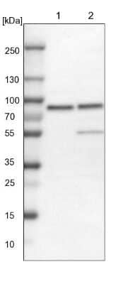 Western Blot: PLAP Antibody [NBP1-84996] - Lane 1: NIH-3T3 cell lysate (Mouse embryonic fibroblast cells). Lane 2: NBT-II cell lysate (Rat Wistar bladder tumor cells).