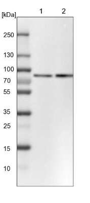 Western Blot: PLAP Antibody [NBP1-84997] - Lane 1: NIH-3T3 cell lysate (Mouse embryonic fibroblast cells). Lane 2: NBT-II cell lysate (Rat Wistar bladder tumor cells).