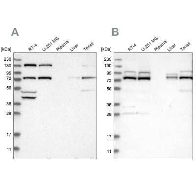 Western Blot: PLAP Antibody [NBP1-84997] - Analysis using Anti-PLAA antibody NBP1-84997 (A) shows similar pattern to independent antibody NBP1-84996 (B).