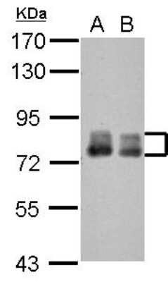 Western Blot: PLAP Antibody [NBP2-19858] - Sample (30 ug of whole cell lysate) A: NT2D1 B: U87-MG 7. 5% SDS PAGE gel, diluted at 1:3000.