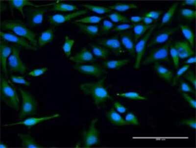 Immunocytochemistry/Immunofluorescence: PLBD1 Antibody [H00079887-D01P] - Analysis of antibody to FLJ22662 on HeLa cell. Antibody concentration 20 ug/ml.