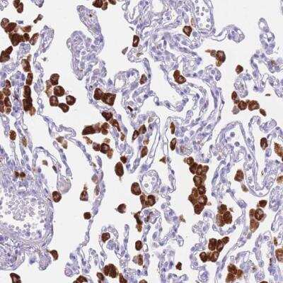 Immunohistochemistry-Paraffin: PLBD1 Antibody [NBP2-37893] - Staining of human lung shows strong cytoplasmic positivity in macrophages.