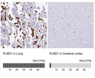 Immunohistochemistry-Paraffin PLBD1 Antibody - BSA Free