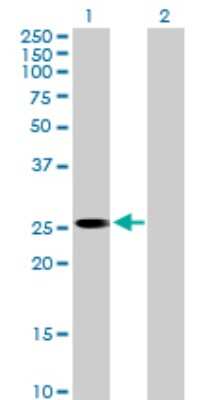 Western Blot: PLBD1 Antibody [H00079887-B01P] - Analysis of FLJ22662 expression in transfected 293T cell line by FLJ22662 polyclonal antibody.  Lane 1: FLJ22662 transfected lysate(24.64 KDa). Lane 2: Non-transfected lysate.