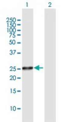 Western Blot PLBD1 Antibody - Azide and BSA Free