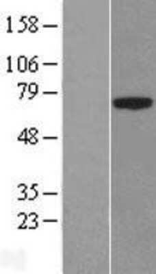 Western Blot: PLBD1 Overexpression Lysate (Adult Normal) [NBL1-10759] Left-Empty vector transfected control cell lysate (HEK293 cell lysate); Right -Over-expression Lysate for PLBD1.