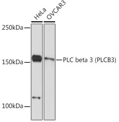Western Blot: PLC-beta 3 Antibody (4C0Z7) [NBP3-15885] - Western blot analysis of extracts of various cell lines, using PLC beta 3 (PLC-beta 3) Rabbit mAb (NBP3-15885) at 1:1000 dilution. Secondary antibody: HRP Goat Anti-Rabbit IgG (H+L) at 1:10000 dilution. Lysates/proteins: 25ug per lane. Blocking buffer: 3% nonfat dry milk in TBST. Detection: ECL Basic Kit. Exposure time: 90s.