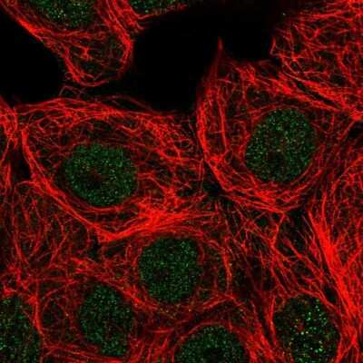 <b>Independent Antibodies Validation. </b>Immunocytochemistry/Immunofluorescence: PLC-beta 3 Antibody [NBP2-32026] - Immunofluorescent staining of human cell line MCF7 shows localization to nucleoplasm.
