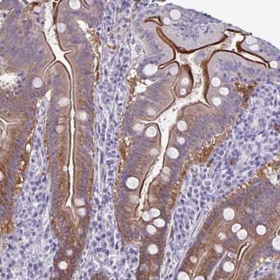 Immunohistochemistry: PLC-beta 3 Antibody [NBP2-32026] - Staining of human small intestine shows moderate cytoplasmic and luminal membranous positivity in glandular cells.