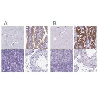<b>Independent Antibodies Validation. </b>Immunohistochemistry-Paraffin: PLC-beta 3 Antibody [NBP2-32026] - Staining of human cerebral cortex, duodenum, lymph node and testis using Anti-PLCB3 antibody NBP2-32026 (A) shows similar protein distribution across tissues to independent antibody NBP2-31974 (B).