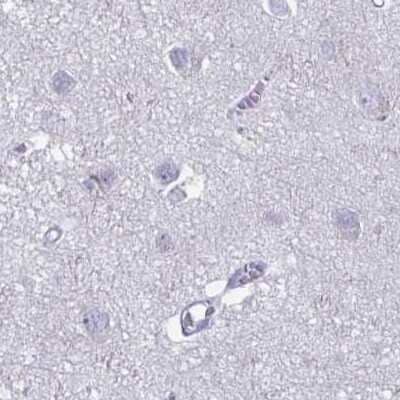 Immunohistochemistry-Paraffin: PLC-beta 3 Antibody [NBP2-32026] - Staining of human cerebral cortex.